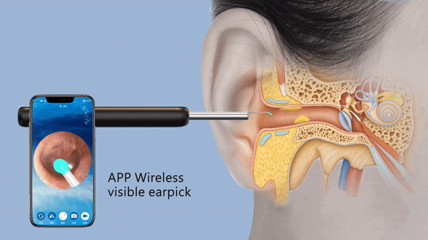 Smart Visual Ear Otoscope Endoscope Wax Removal Tool (3)